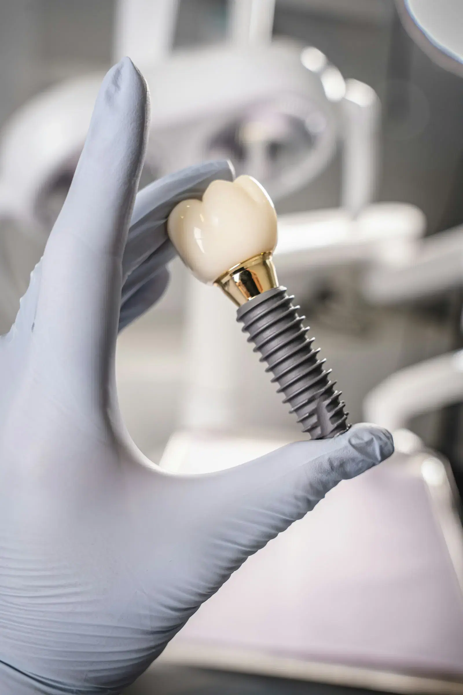 A dental implant post with its crown, held in a gloved hand