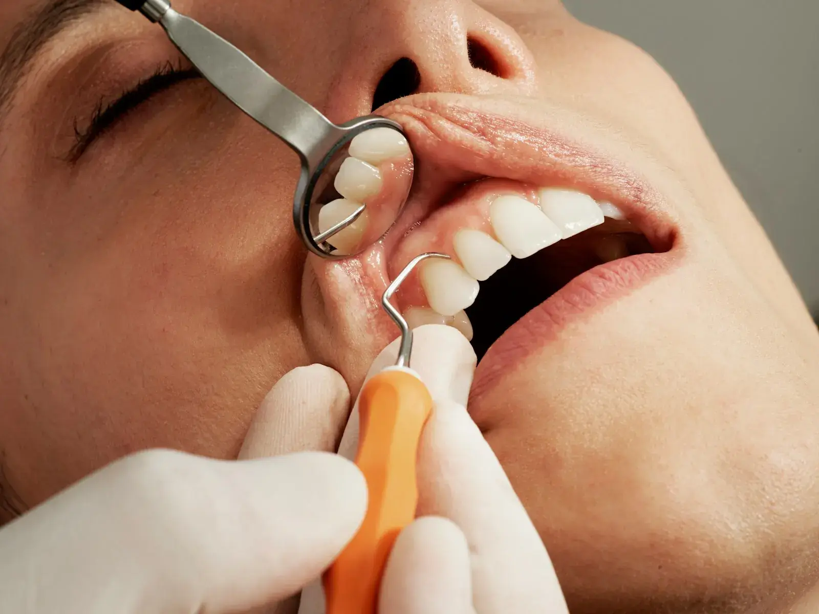 A periodontal exam of the gums with a probe and mirror